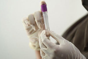 Coronavirus Antikörpertest Coronavirus Antikörpertest